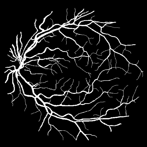Przykładowa maska, na której widać, że naczynia stanowią małą część całego obrazu